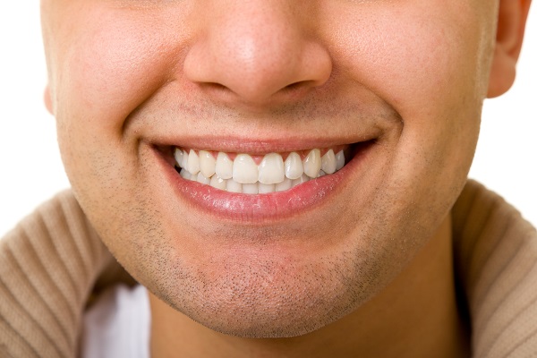 Reasons To Consider InBrace For Teeth Straightening