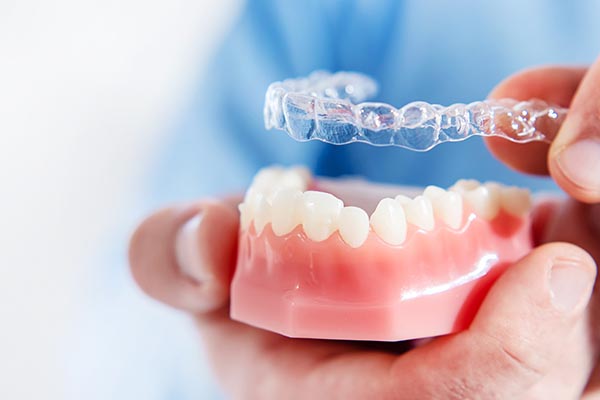 An Orthodontist Shares Reasons Clear Aligners May Be Right for You from Smile By Dr. K in Chatsworth, CA